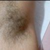 thumb_0